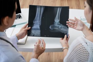 Dokter Spesialis Orthopedi Blitar, Ini 2 Rekomendasi Terbaik