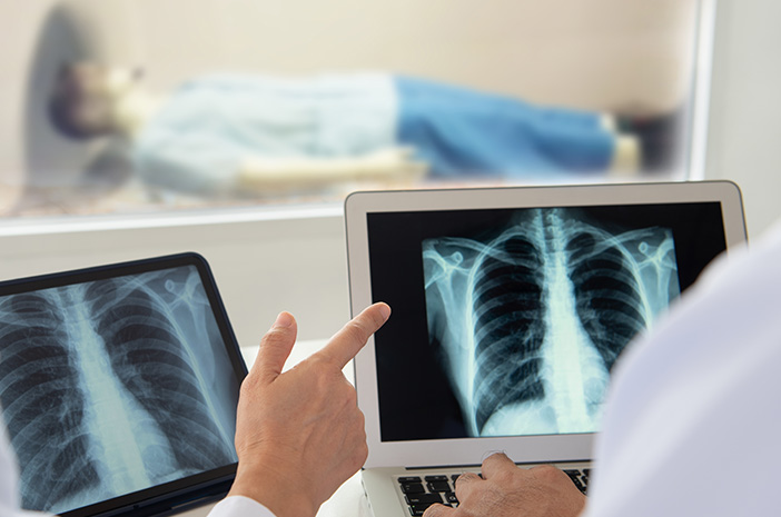 Ini Jadwal Praktek Dokter Spesialis Radiologi Sumenep, Catat ya!