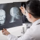 Pilihan Dokter Spesialis Radiologi Situbondo, Catat Jadwalnya