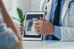 Dokter Spesialis Paru Banjarnegara, Berikut Info Prakteknya