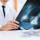 3 Rekomendasi Dokter Spesialis Penyakit Dalam Karanganyar