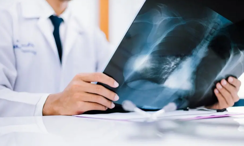 3 Rekomendasi Dokter Spesialis Penyakit Dalam Karanganyar