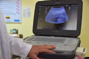 dokter spesialis kandungan Purbalingga