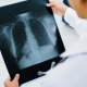 dokter spesialis paru Batang