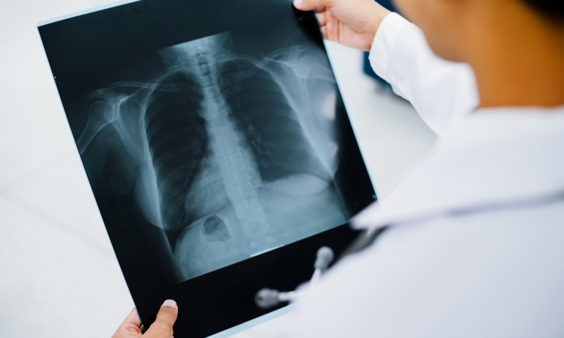 dokter spesialis paru Batang