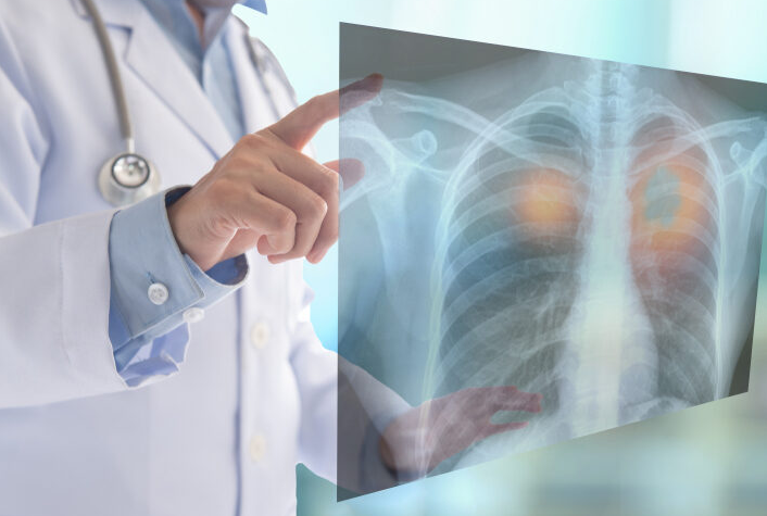 2 Pilihan Dokter Spesialis Paru Brebes, Yuk Simak Jadwalnya