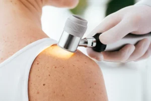 dokter spesialis kulit Purbalingga